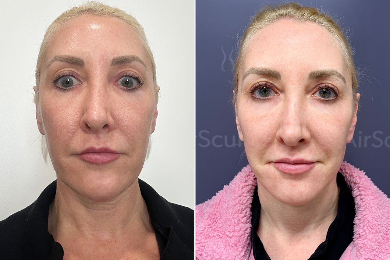 Plastic Surgeon Known As ‘The Surgeonista’ Got a Facelift at 43