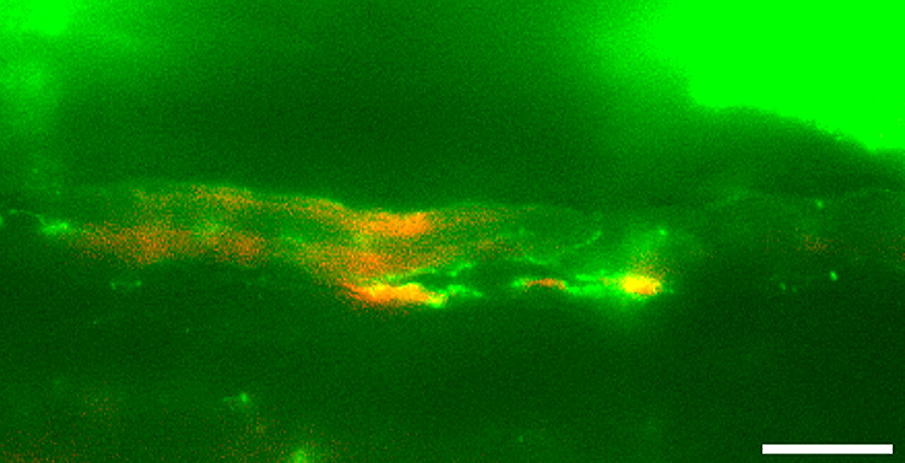 Researchers discover the eye's hidden cleanup system