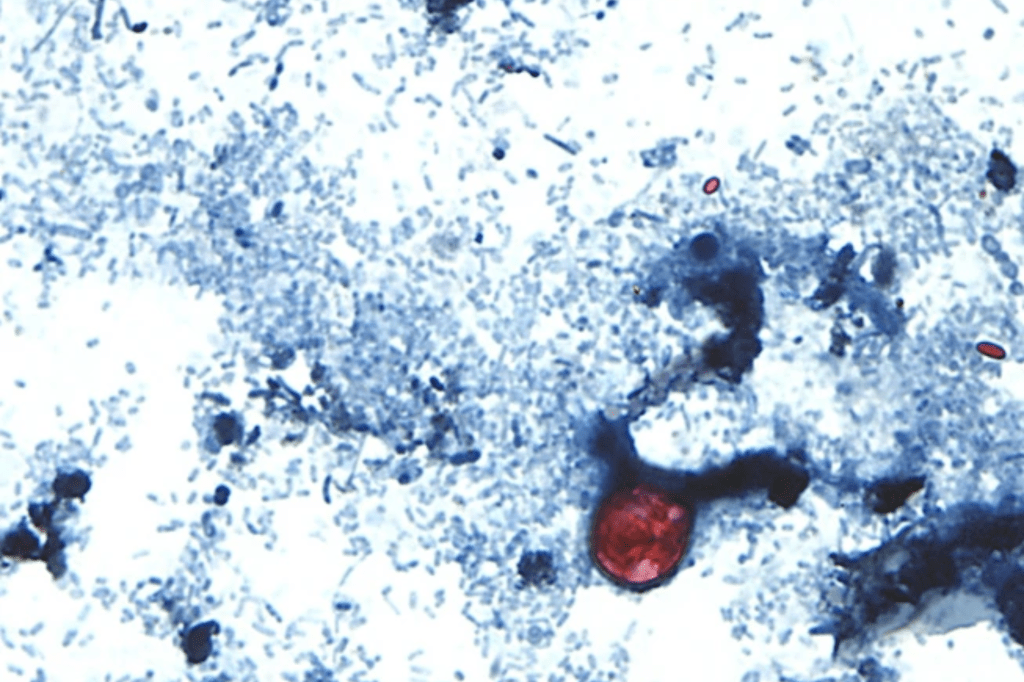 List of major retailers pulling products over cyclospora outbreak