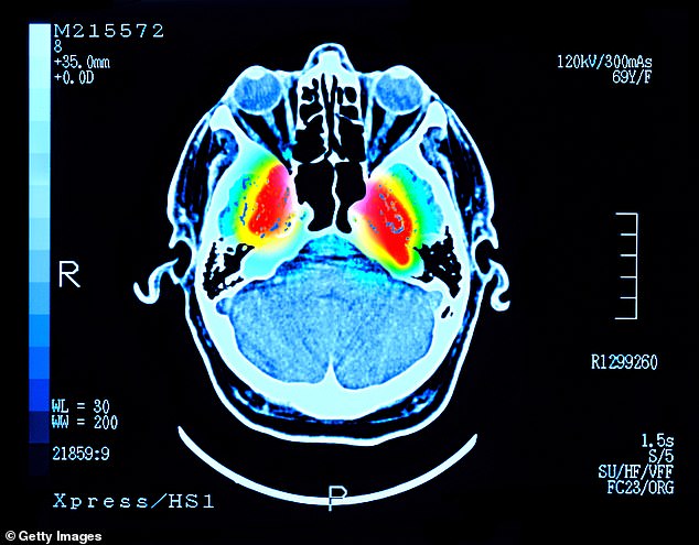 People with advanced Alzheimer's disease have occasionally been reported to suddenly recognize loved ones, recall long–forgotten memories and hold coherent conversations shortly before death in a phenomenon known as terminal lucidity