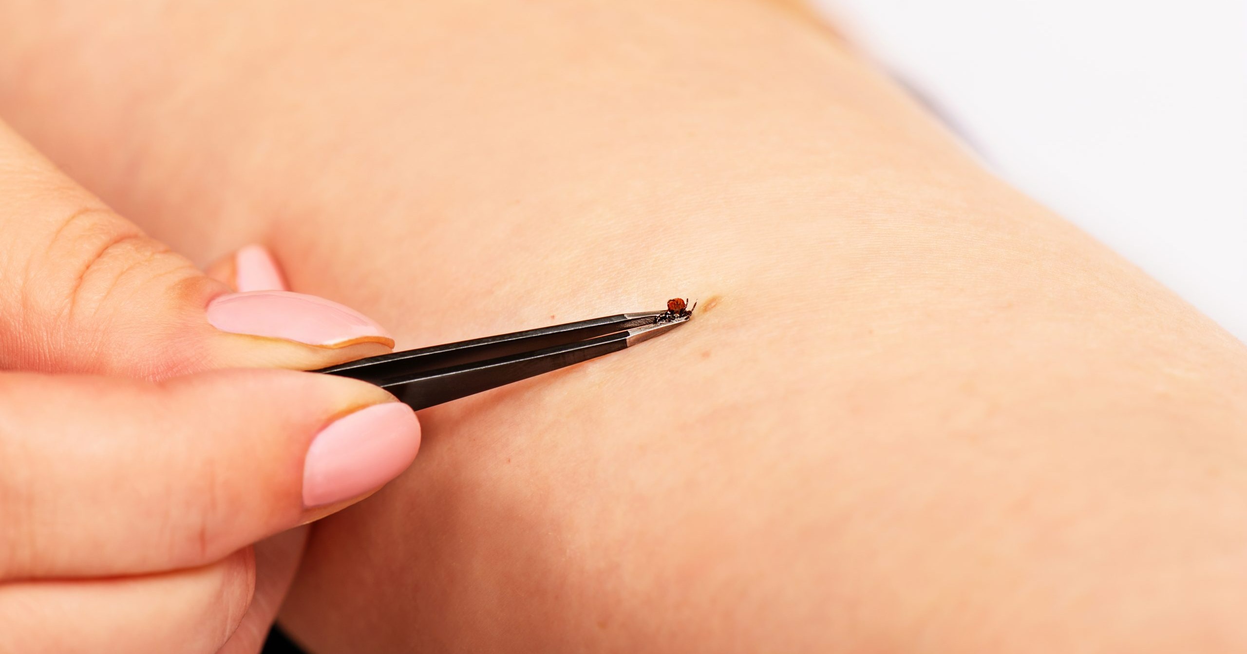 Ticks reassert themselves in Minnesota, prompting vigilance