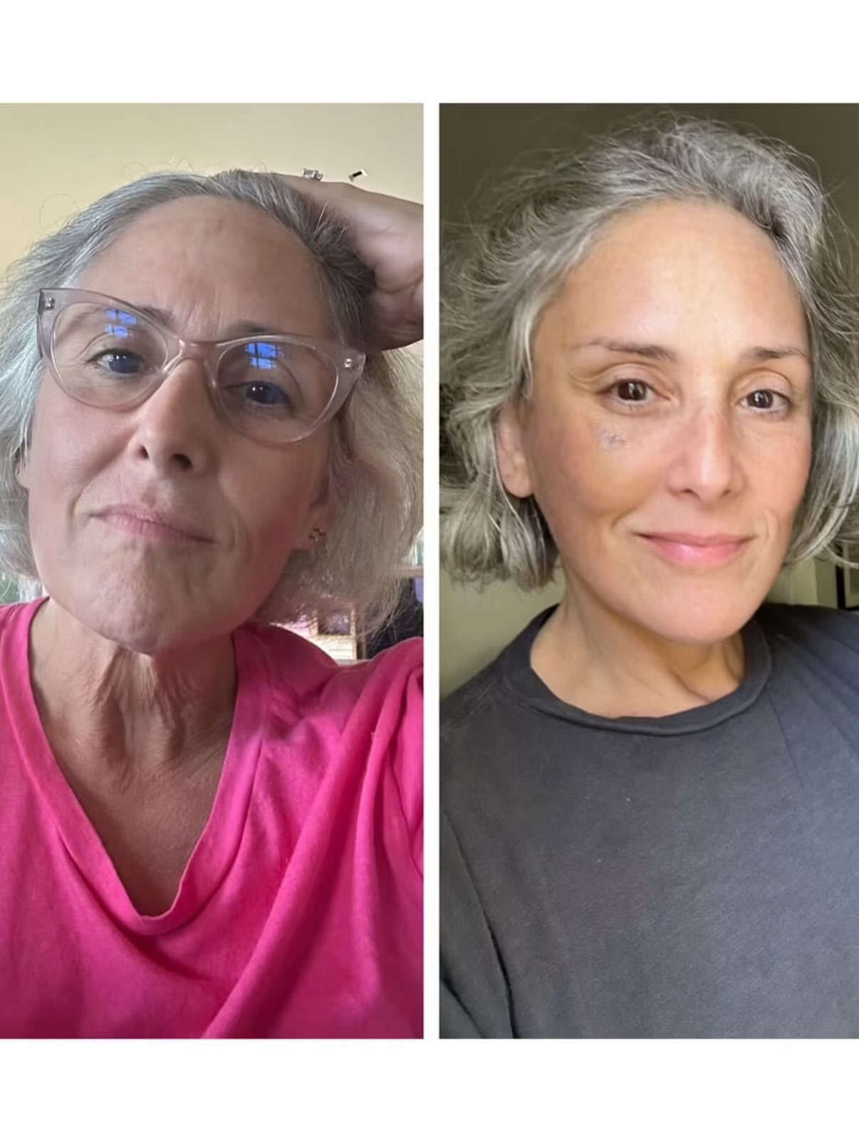 Collage of two images of Ricki Lake, one before and one after her facelift.
