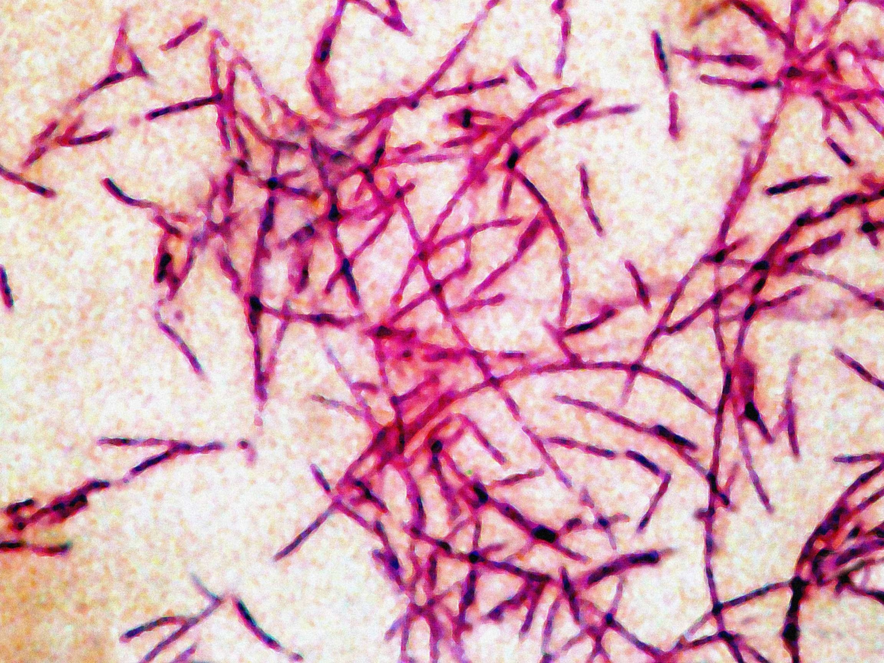 3rd person dies from Legionnaires' disease in New York City