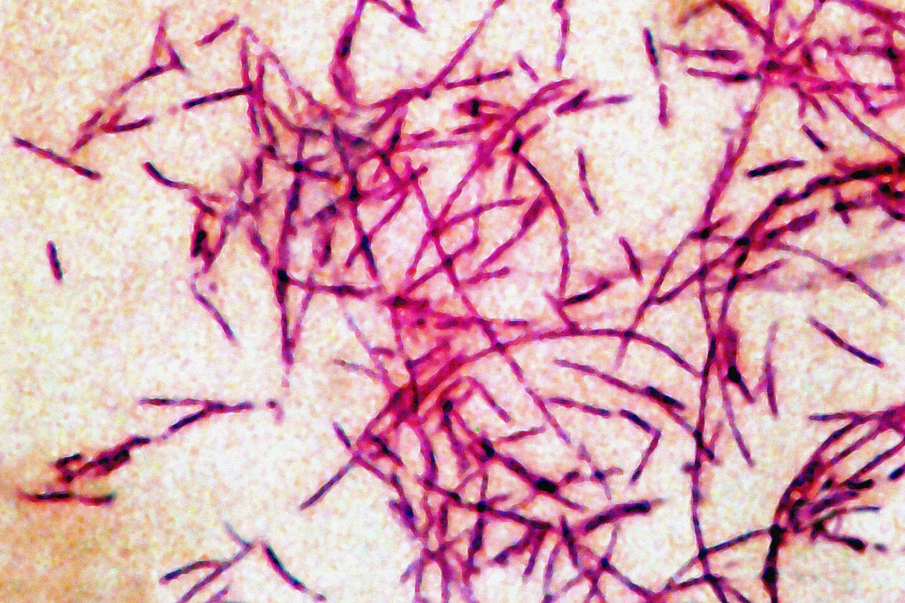 3rd person dies from Legionnaires' disease in New York City