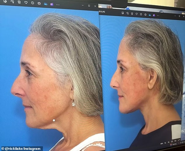 Ricki Lake, 57, shares before-and-after facelift photos