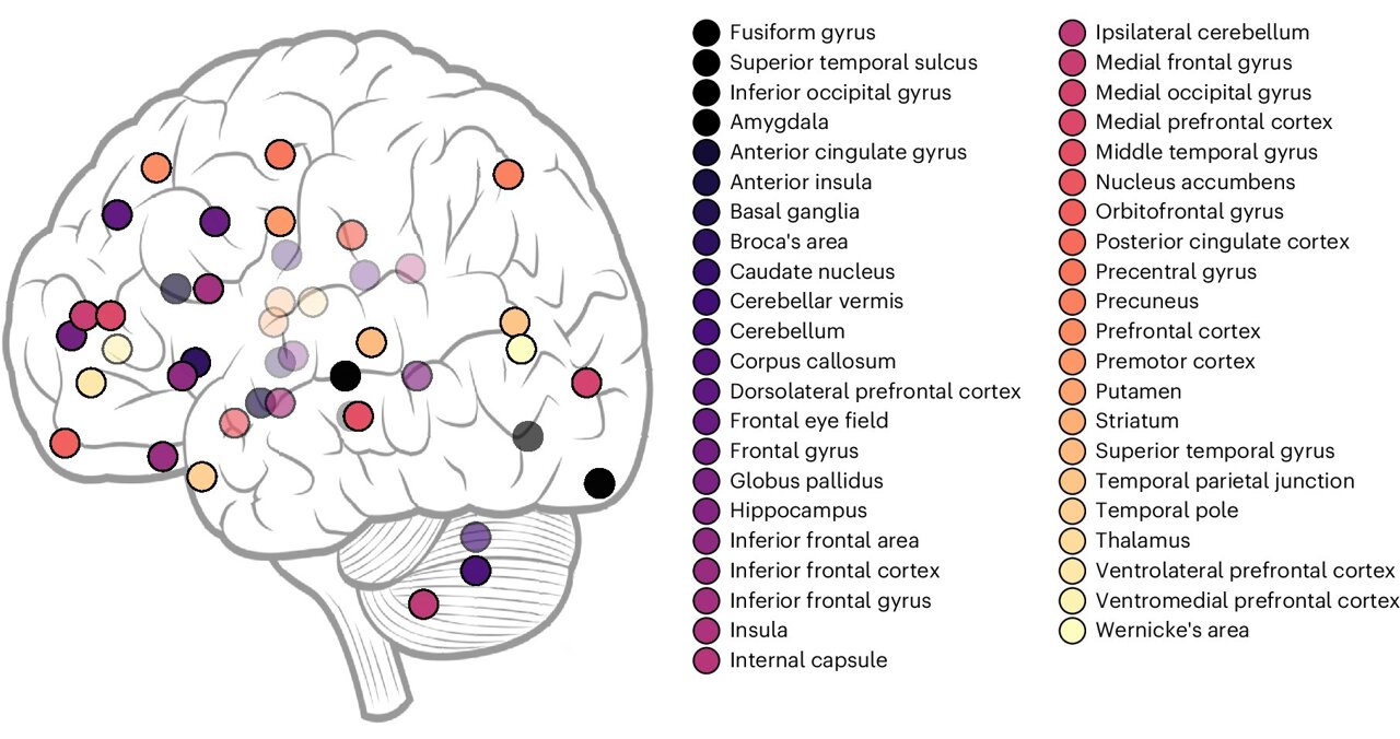 How autistic brains process faces differently