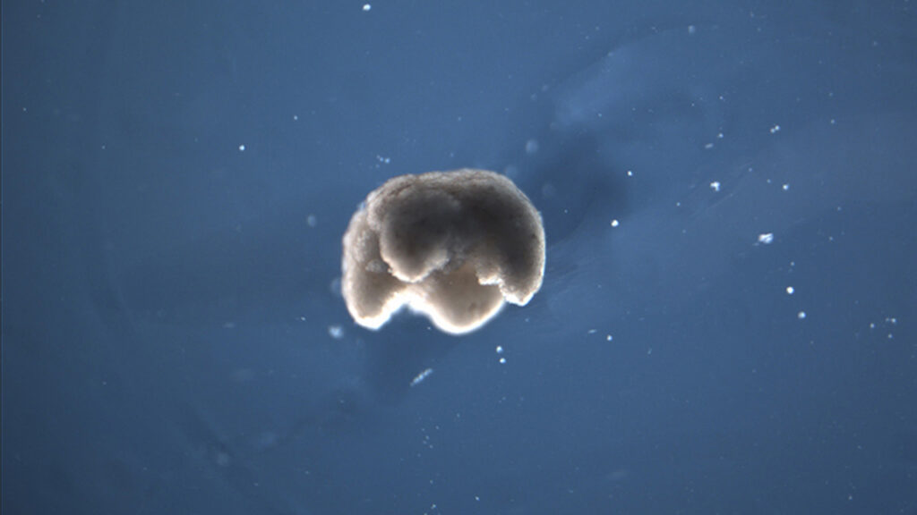 Scientists Created the World’s First Living Robot