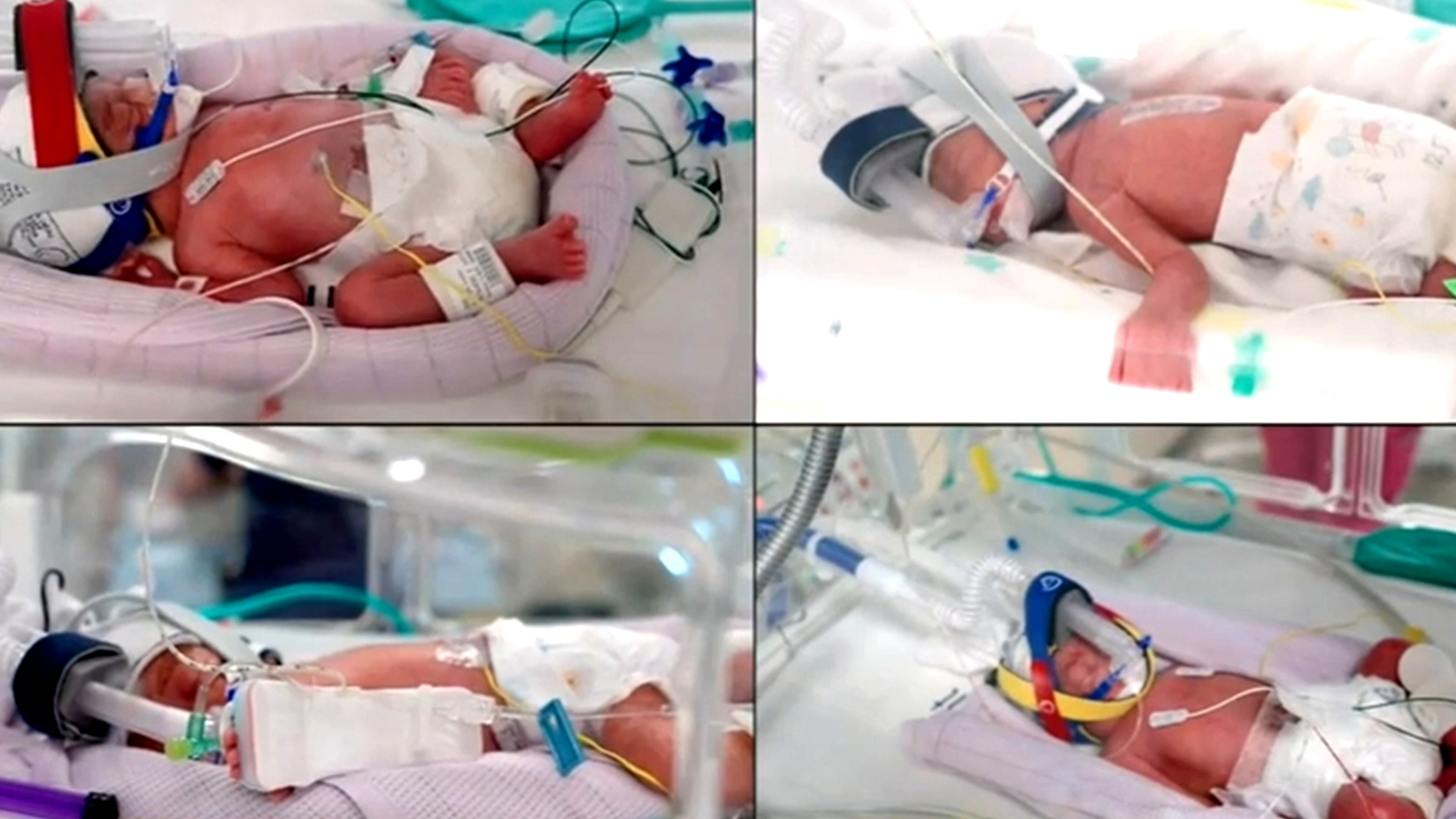 Mum gives birth to ultra rare identical quadruplets