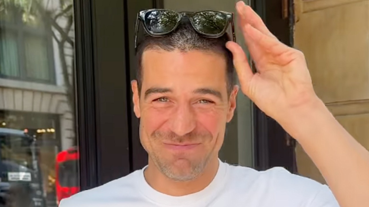 ‘DWTS’ Alum Joe Amabile Shaves Head Before Brain Surgery, Jokes He’s Giving Doctors ‘Easy Access’