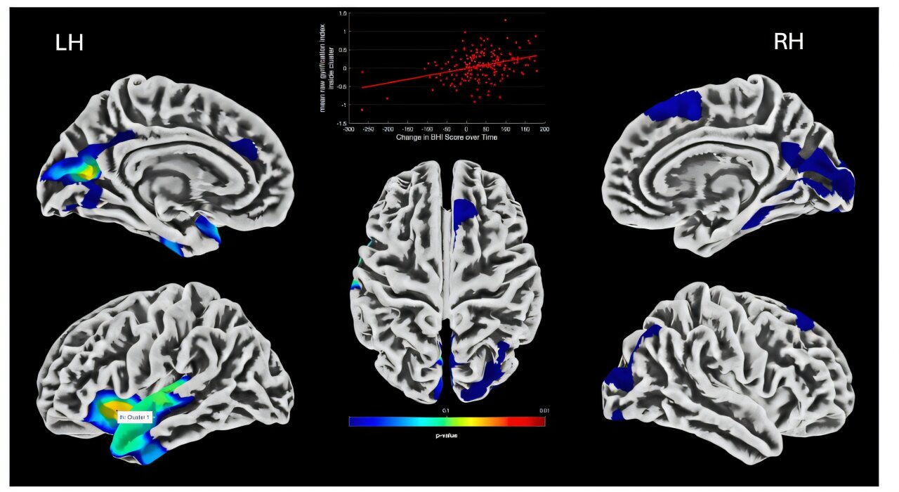 Newly identified MRI biomarkers reveal physical brain changes from cognitive training, study finds