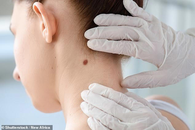Melanoma deaths have significantly dropped in Australia due to heightened awareness, but experts are warning Aussies not to become complacent