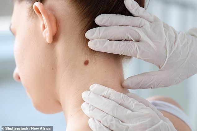Melanoma deaths have significantly dropped in Australia due to heightened awareness, but experts are warning Aussies not to become complacent