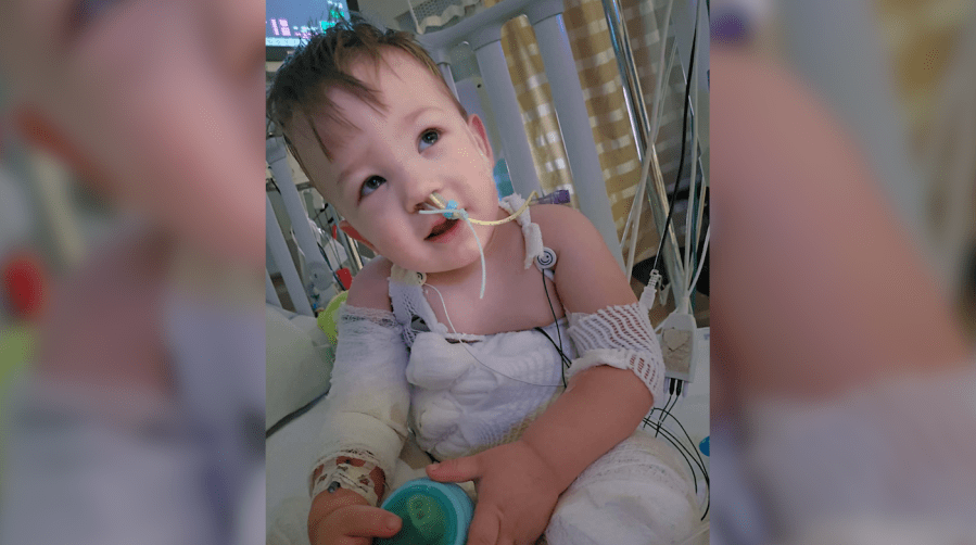 Somerset toddler faces long recovery after severe Crock-Pot burn accident