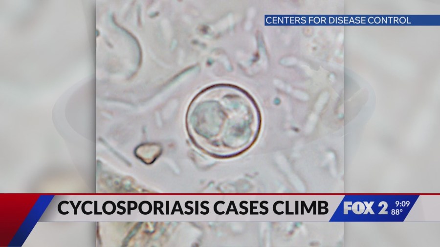 Missouri reports sharp increase in Cyclospora infections
