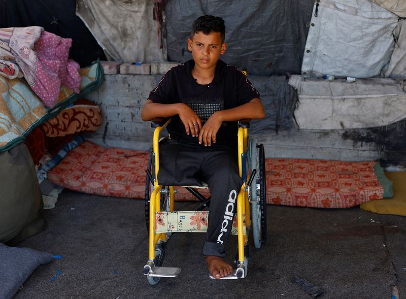 Omar Rami Halawa, 13, whose right foot was amputated after he was wounded in an Israeli strike while collecting water at Gaza's seaport, poses for a portrait in Gaza,