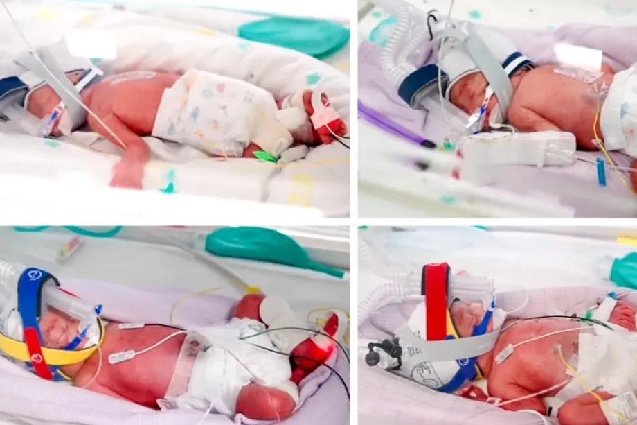 Australia records the birth of exceptionally rare identical quadruplets conceived naturally