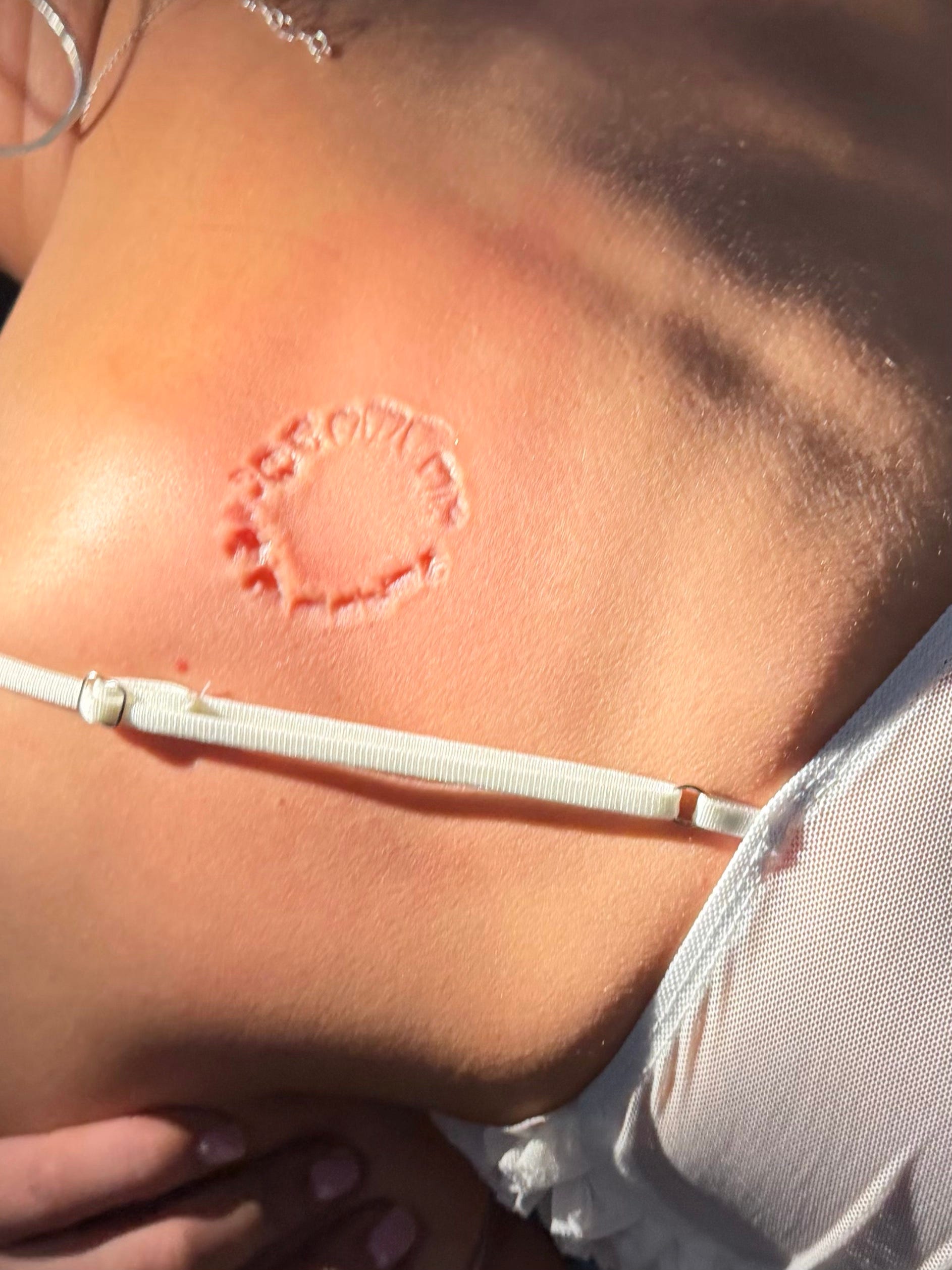 Photo shows severity of Puka Nacua's alleged bite, lawyer says | Exclusive