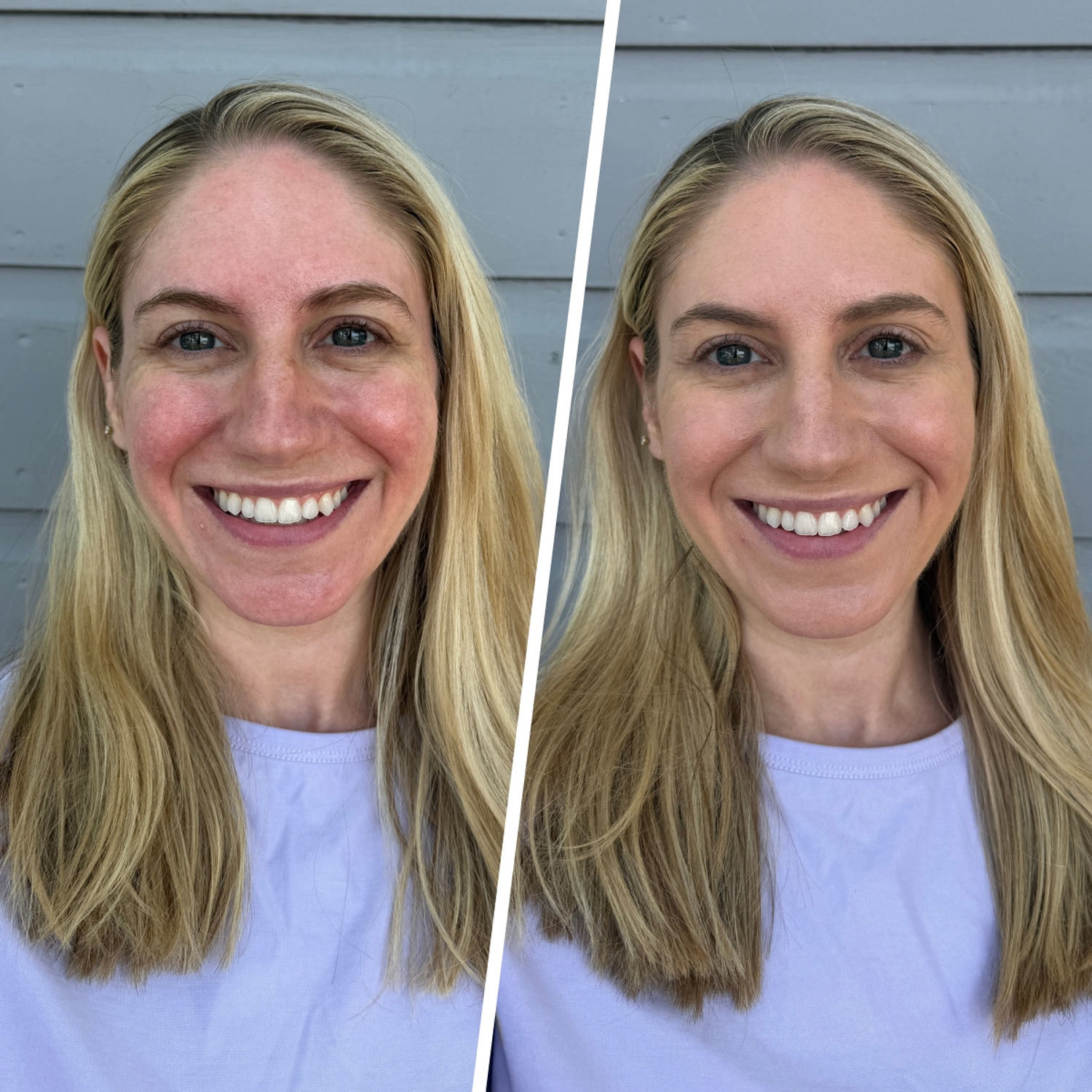 Jones Road Your Skin Foundation Stick Before (left) and after (right) (Courtesy of Dory Zayas)