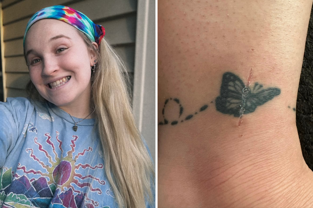 Woman wonders why tattoo hurt so much, scan reveals shocking truth