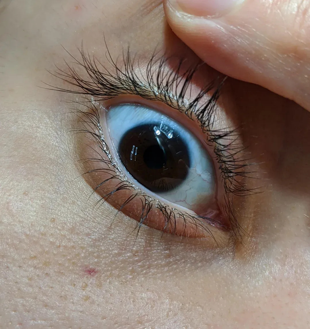 Fascinating physical traits only a few people have