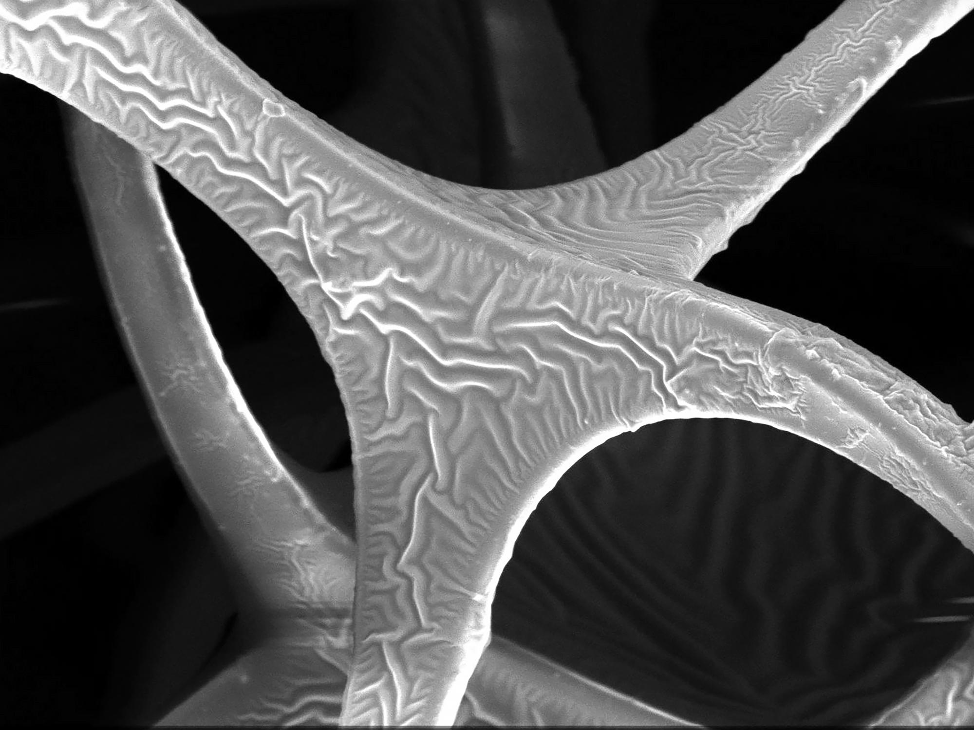 Injectable outlet in the body powers bioelectric implants