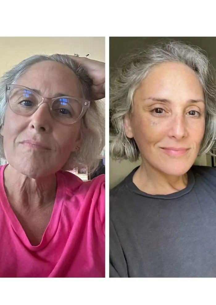 Ricki Lake Shows Off Facelift Results 2 Years Later On Instagram