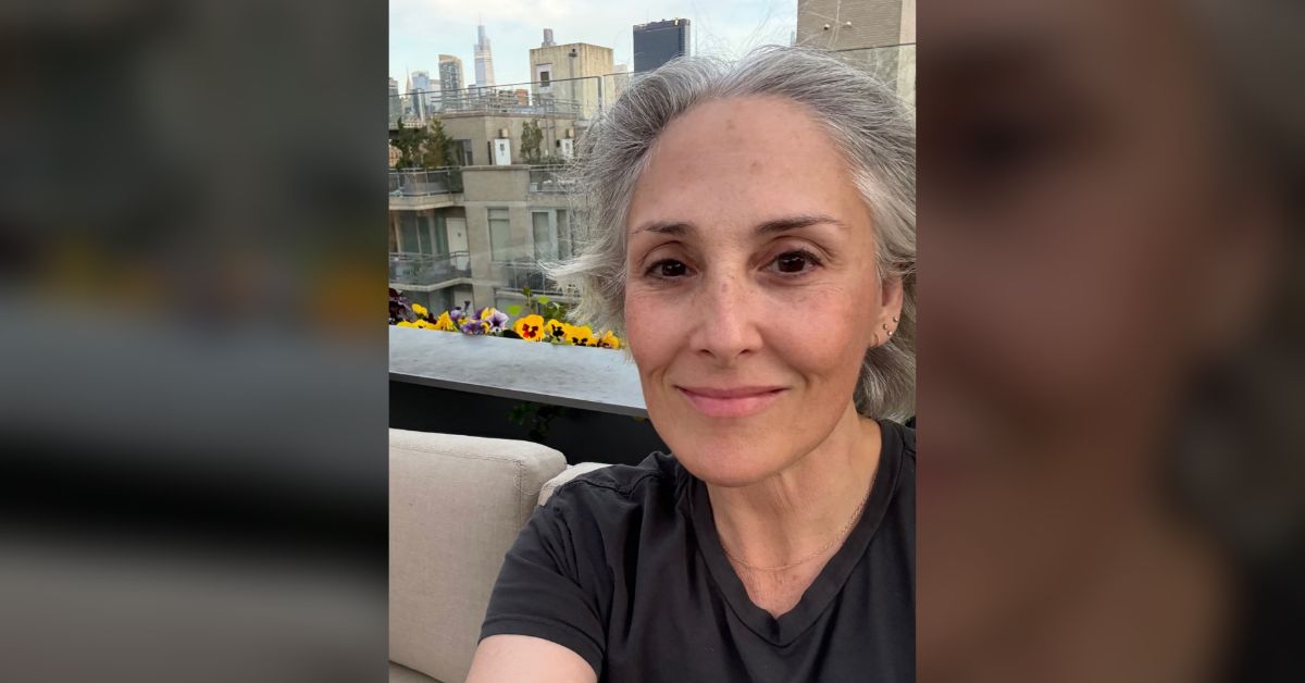 Ricki Lake shares unfiltered before-and-after facelift photos