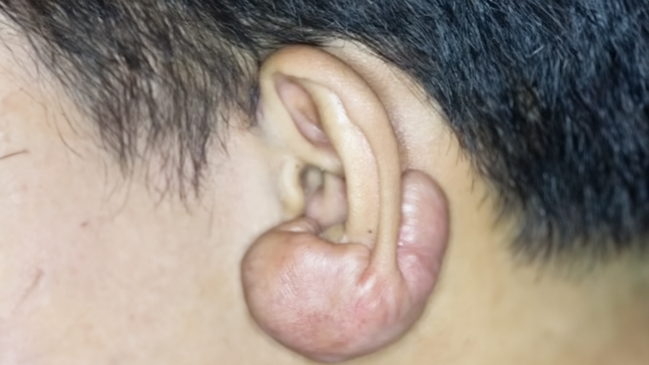 Doctor reacts to a viral scar transformation
