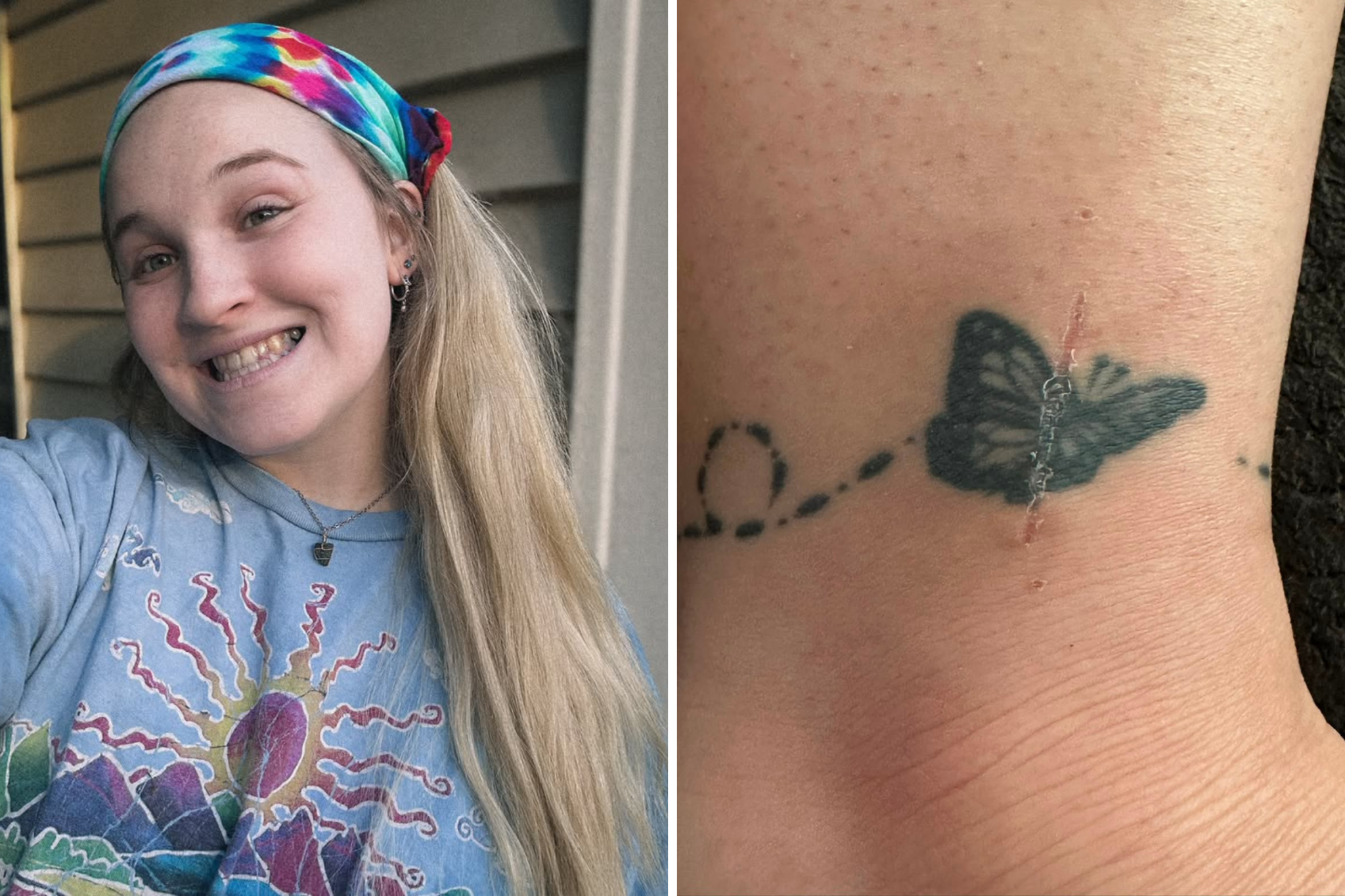 Woman wonders why tattoo hurt so much, scan reveals shocking truth