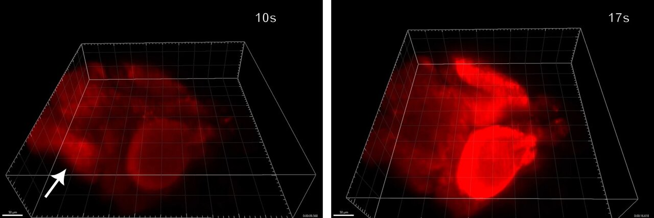 High-speed 3D imaging reveals how seizures move through the brain