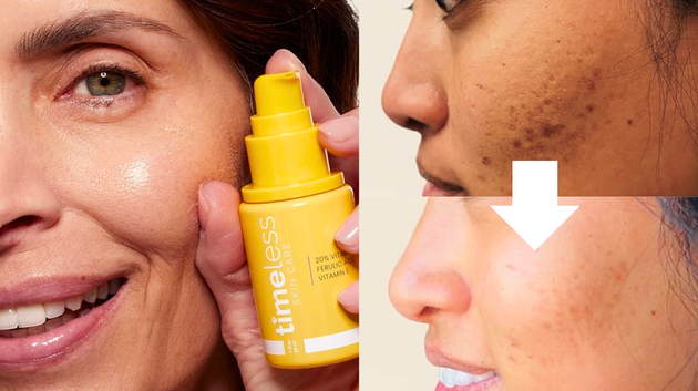 The vitamin C serum people over 50 adore for wrinkles and age spots