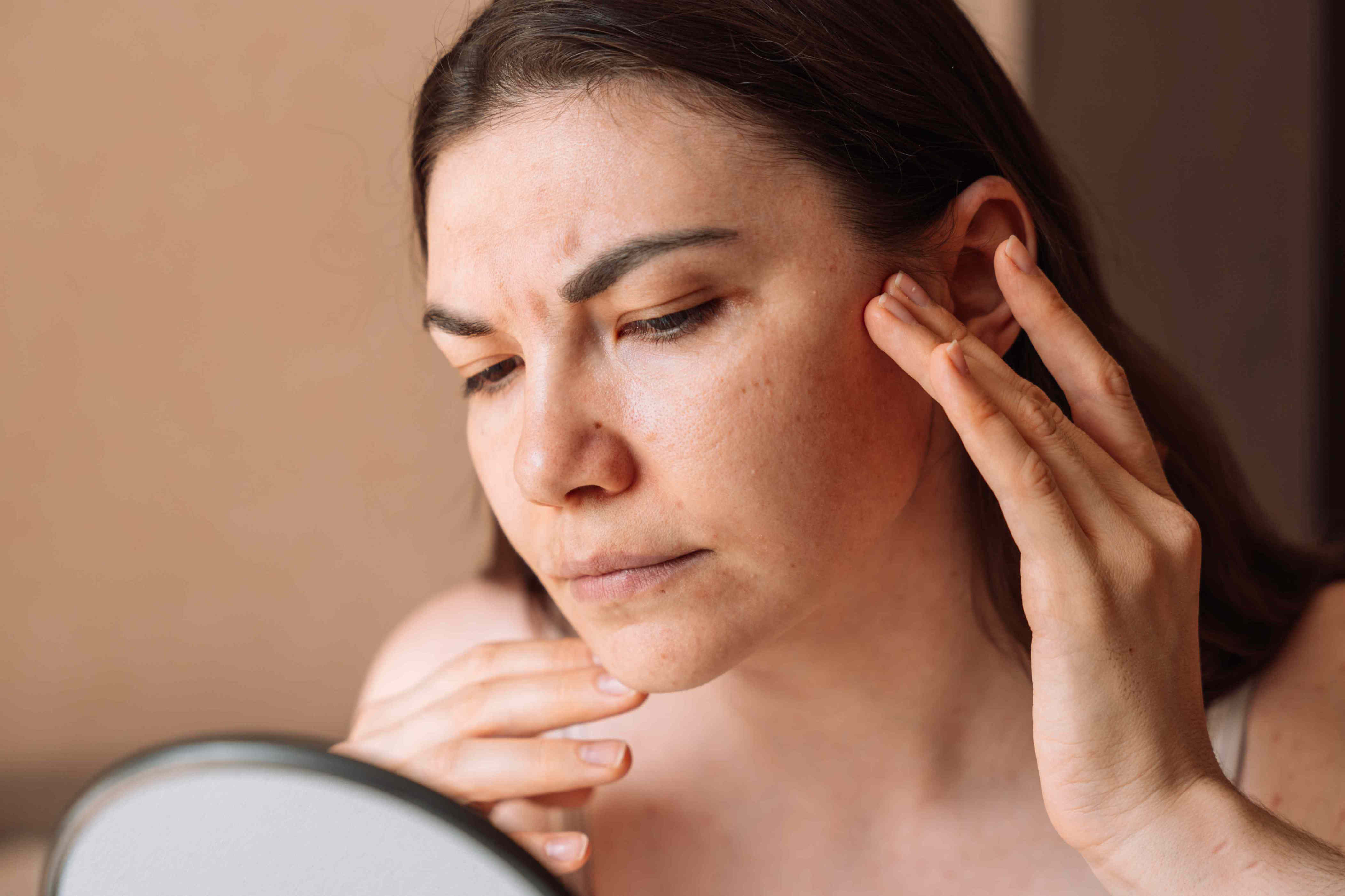 What causes dry patches on your face?