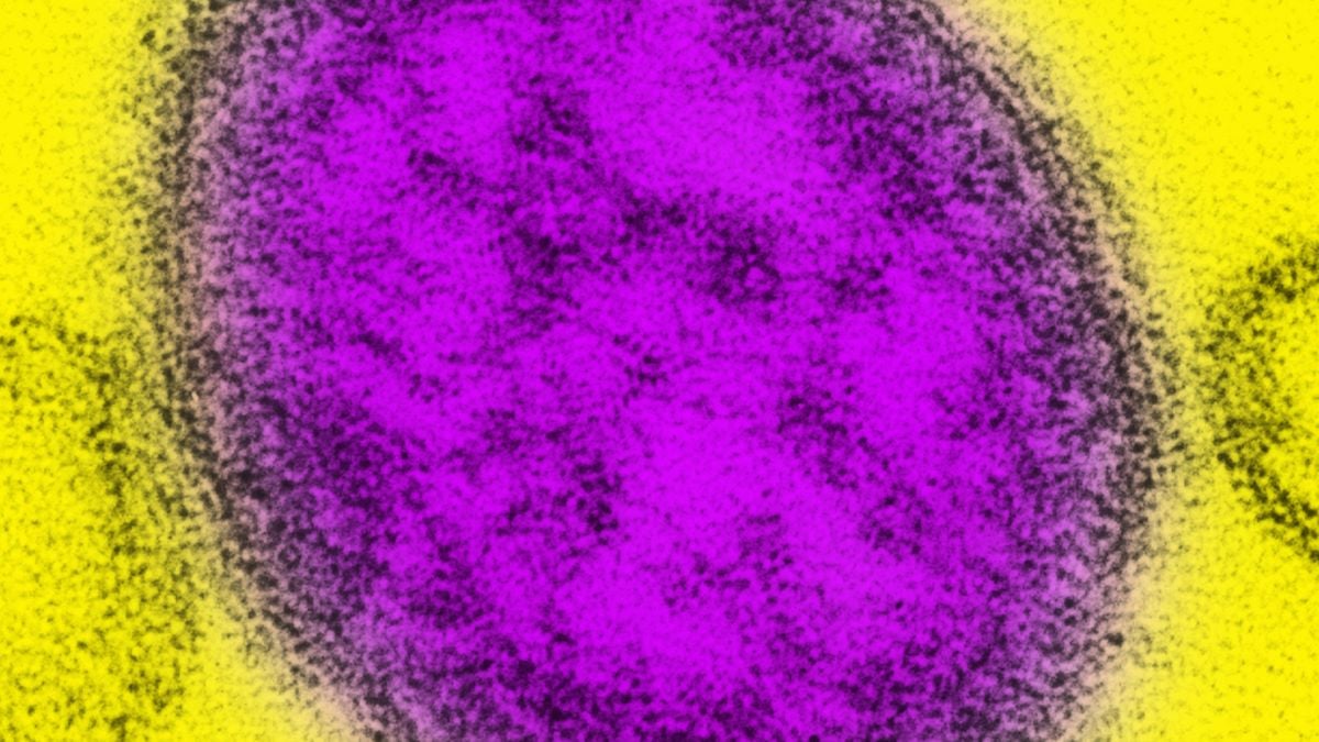 Measles cases in the US just hit a 35-year high. Here's what's driving the surge, and what you need to know