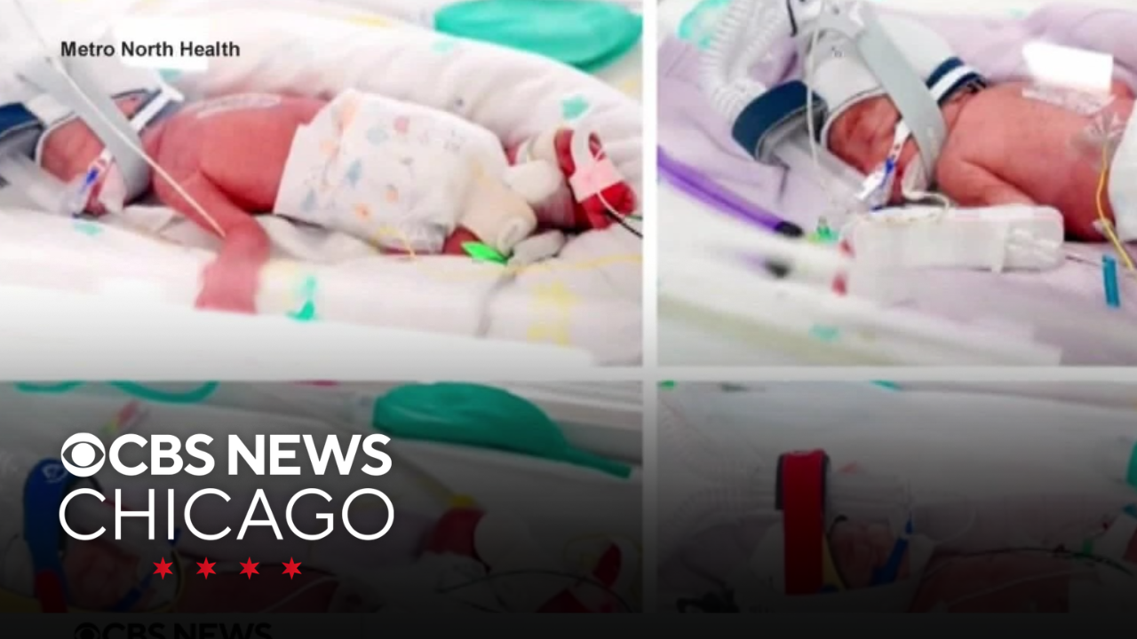 Australian woman delivers identical quadruplets