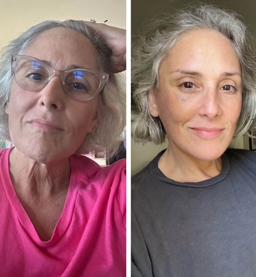 Ricki Lake before and after her facelift