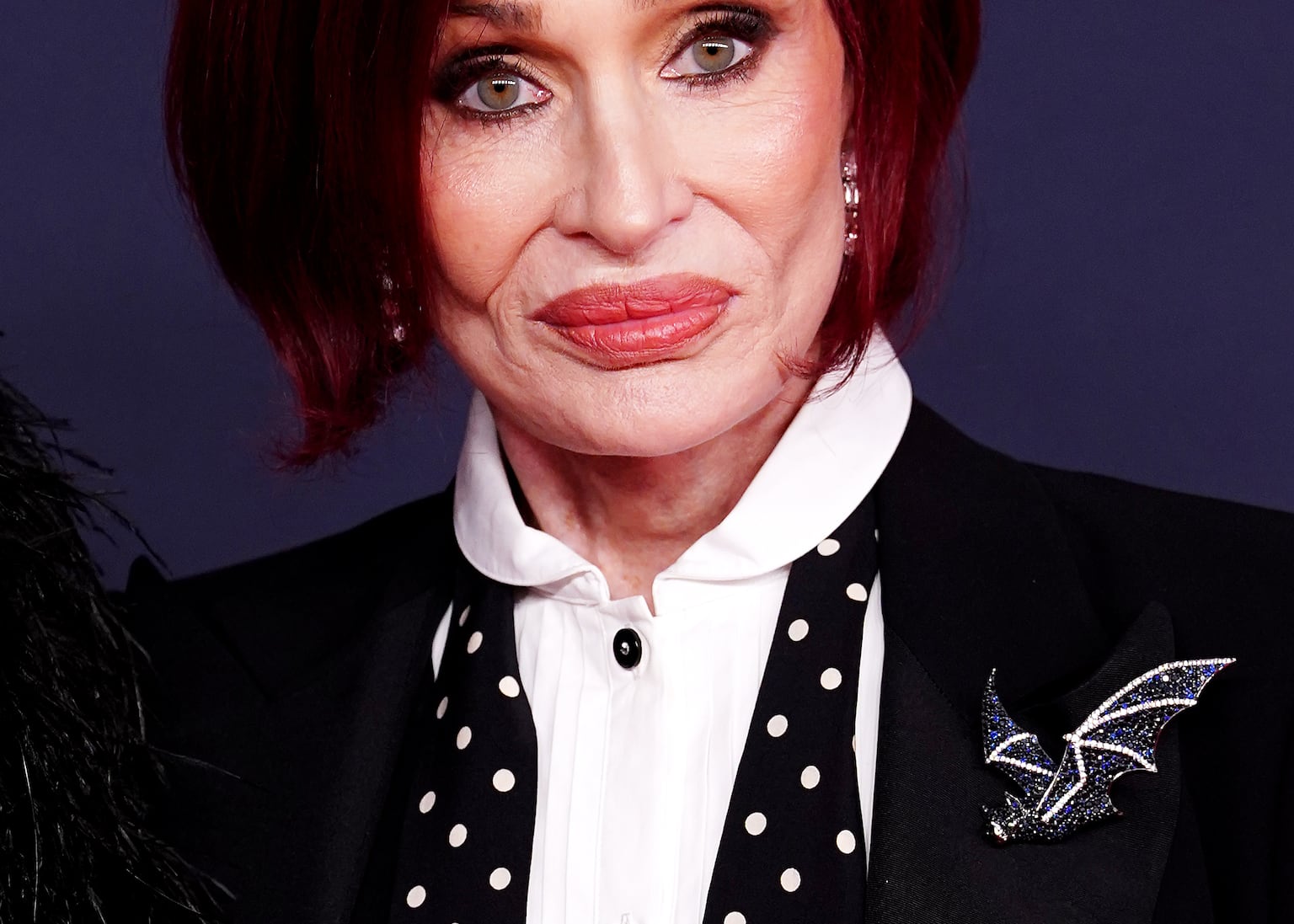 Sharon Osbourne is among stars to reveal she has taken the medication