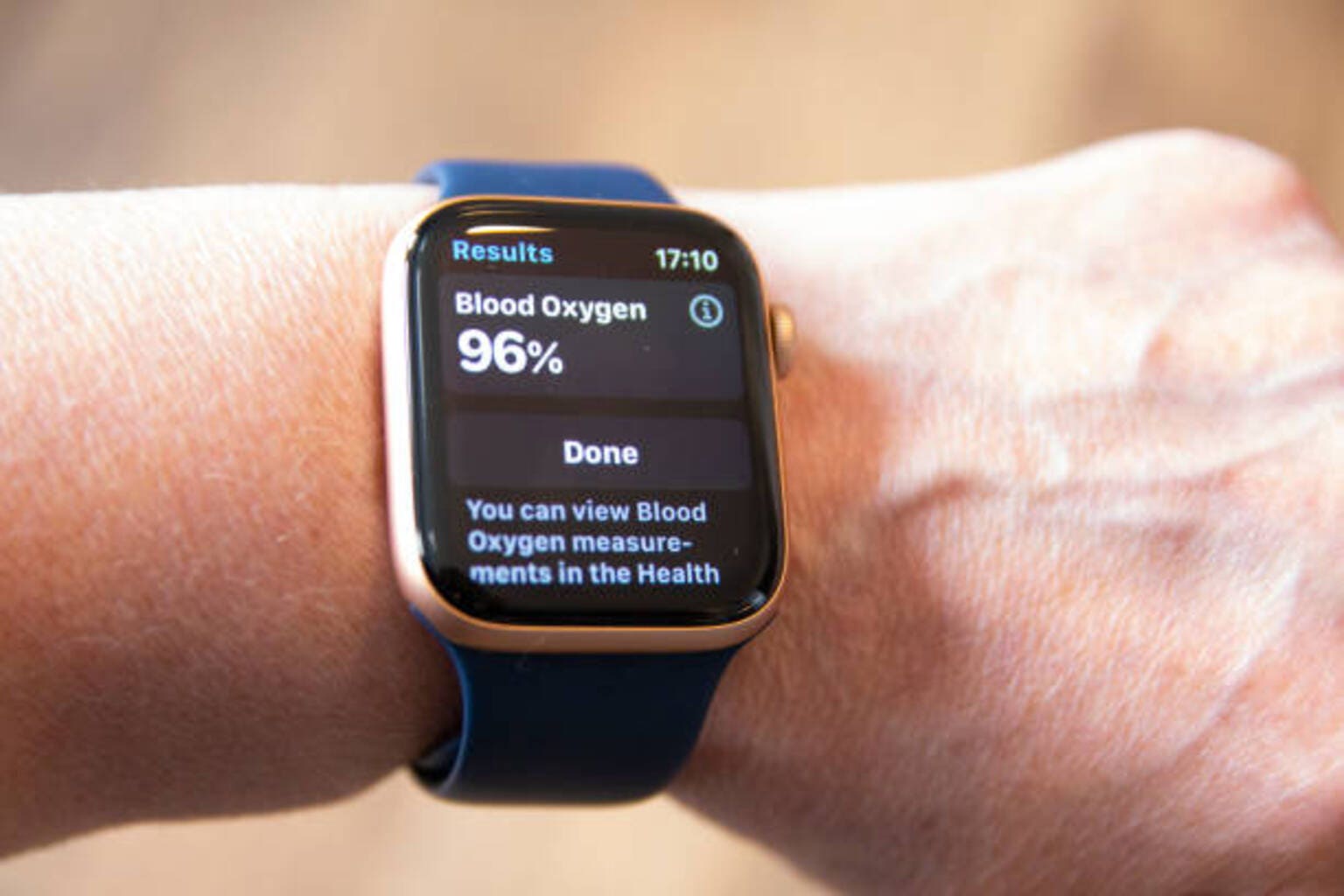 Apple loses bid to overturn $634M Masimo judgment over Apple Watch dispute
