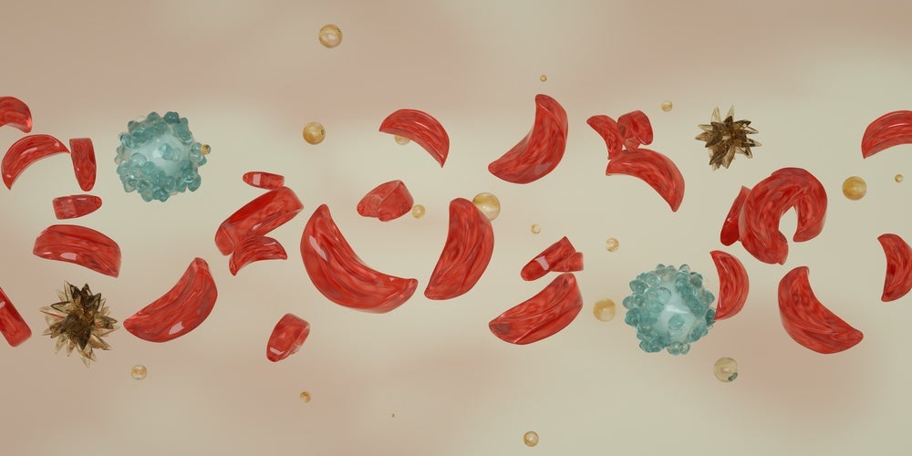 Agios scraps sickle cell drug programme on underwhelming Phase II data