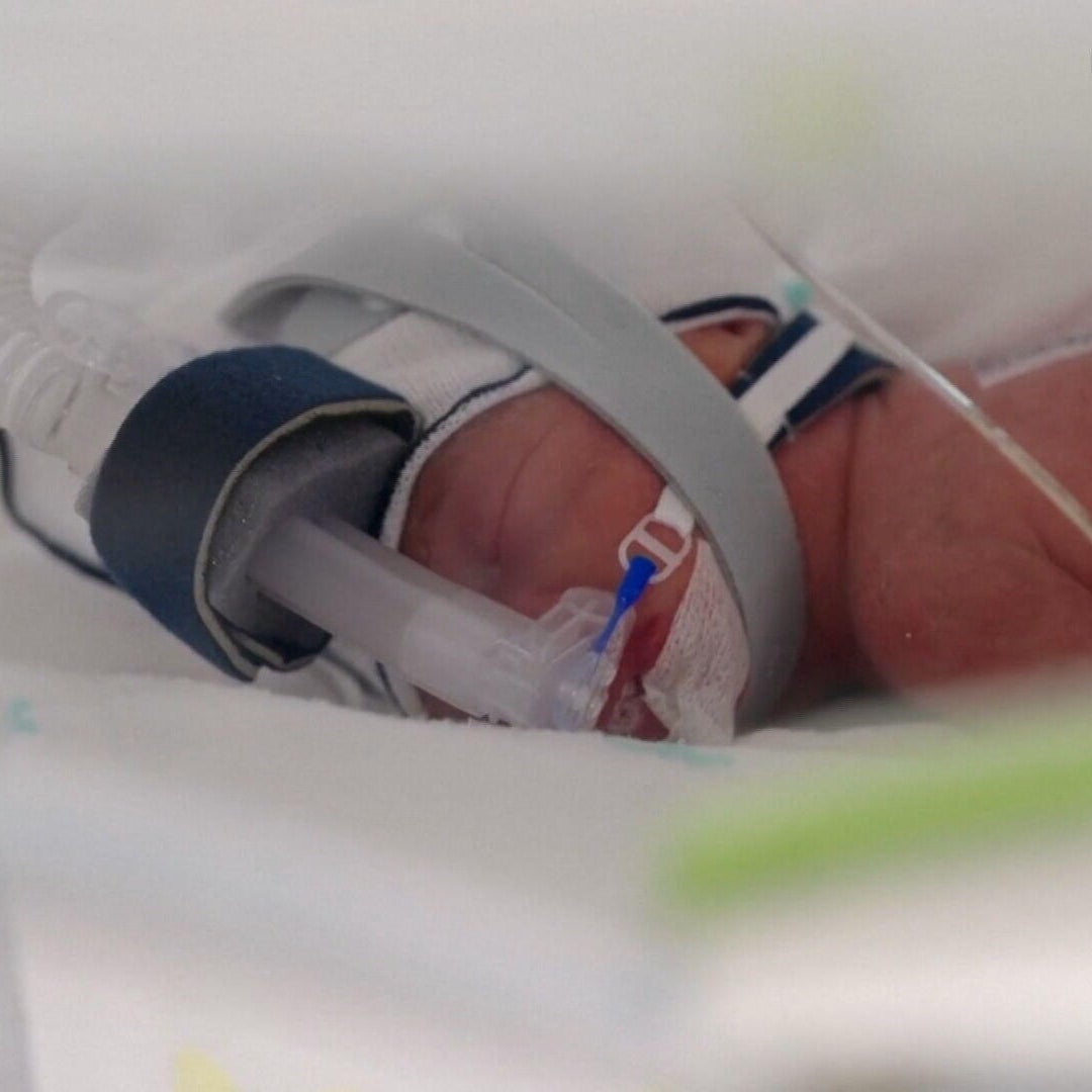 Australian woman gives birth to rare identical quadruplet daughters