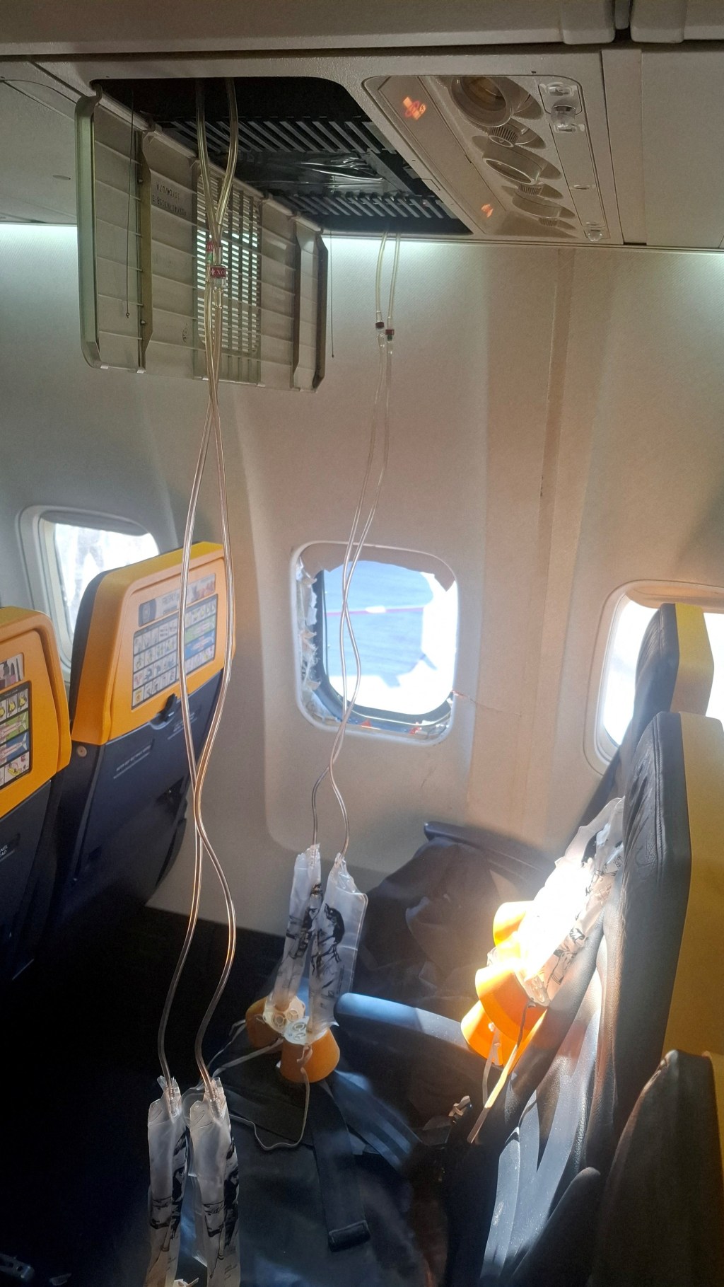 Ryanair passenger recounts horror of getting sucked halfway out airplane window