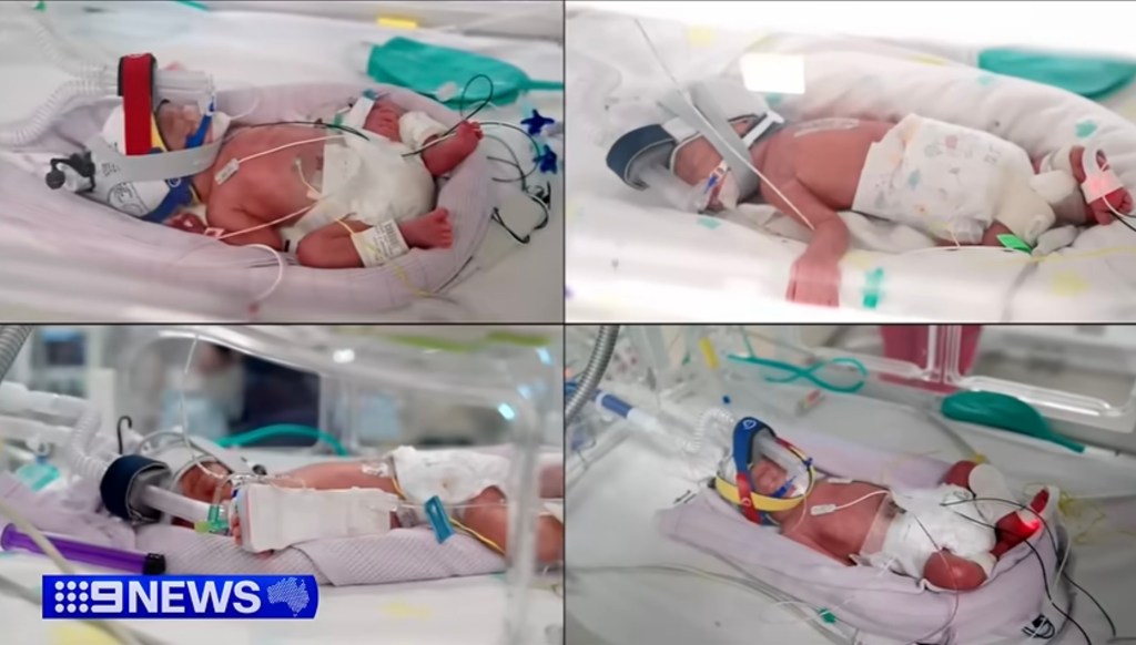 four-precious-miracles-https-www-135143951