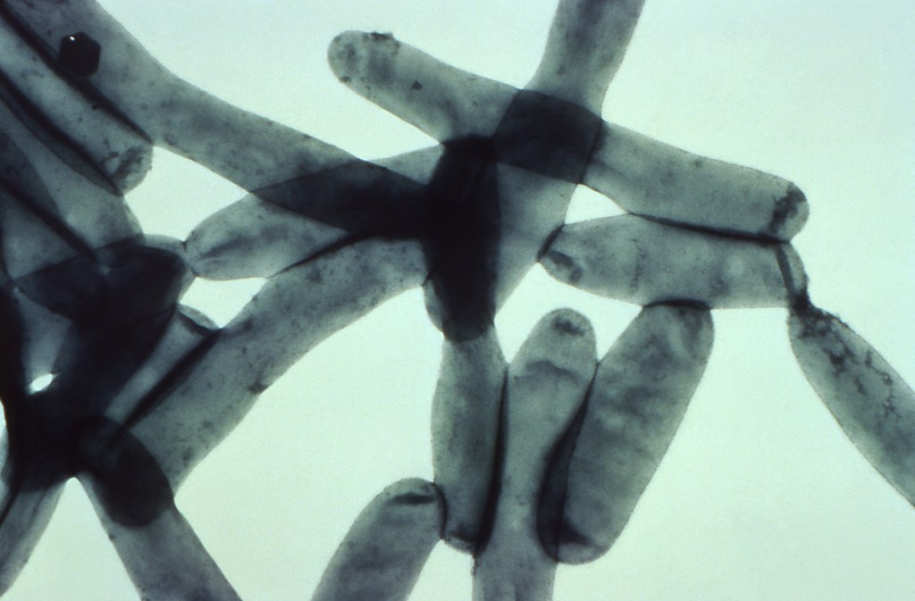 Fifth person dies in Legionnaires’ disease outbreak in NYC