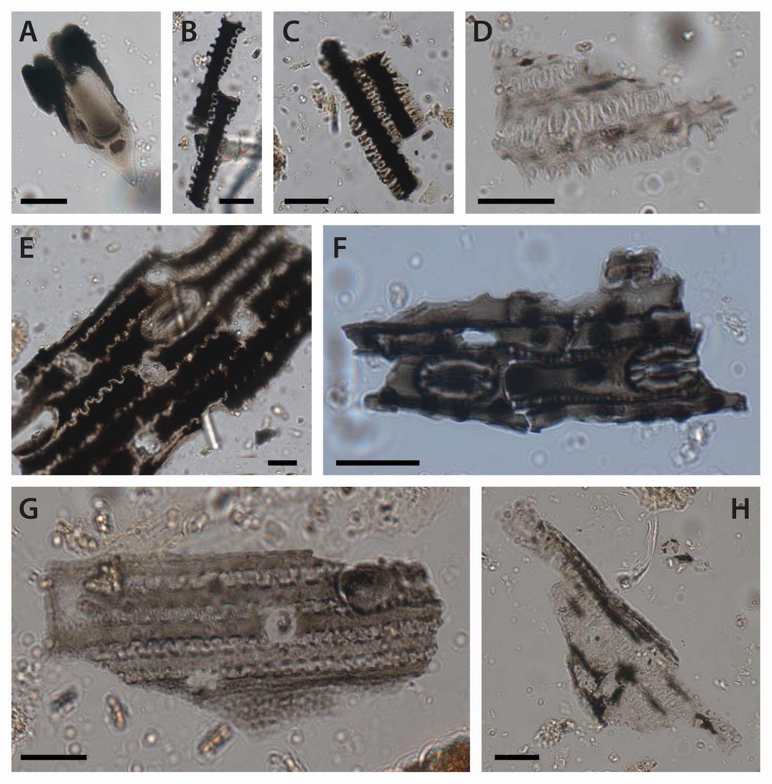 Microscopic images of burnt grass phytoliths from Cloggs Cave. Most of the images depict phytoliths from the inflorescences and leaves of grasses. The scale bar indicates 20 microns. Refer to the journal article for details. Credit: Grono, GunaiKurnai Land and Waters Aboriginal Corporation, et al.