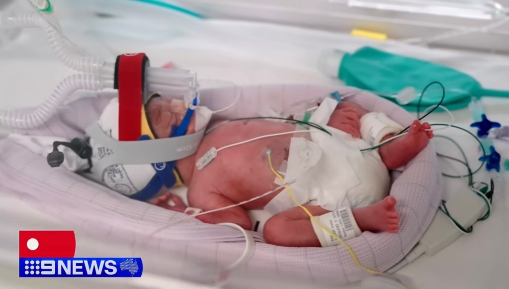 four-precious-miracles-https-www-135143979