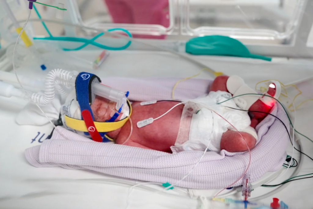 Australia Quadruplet Birth