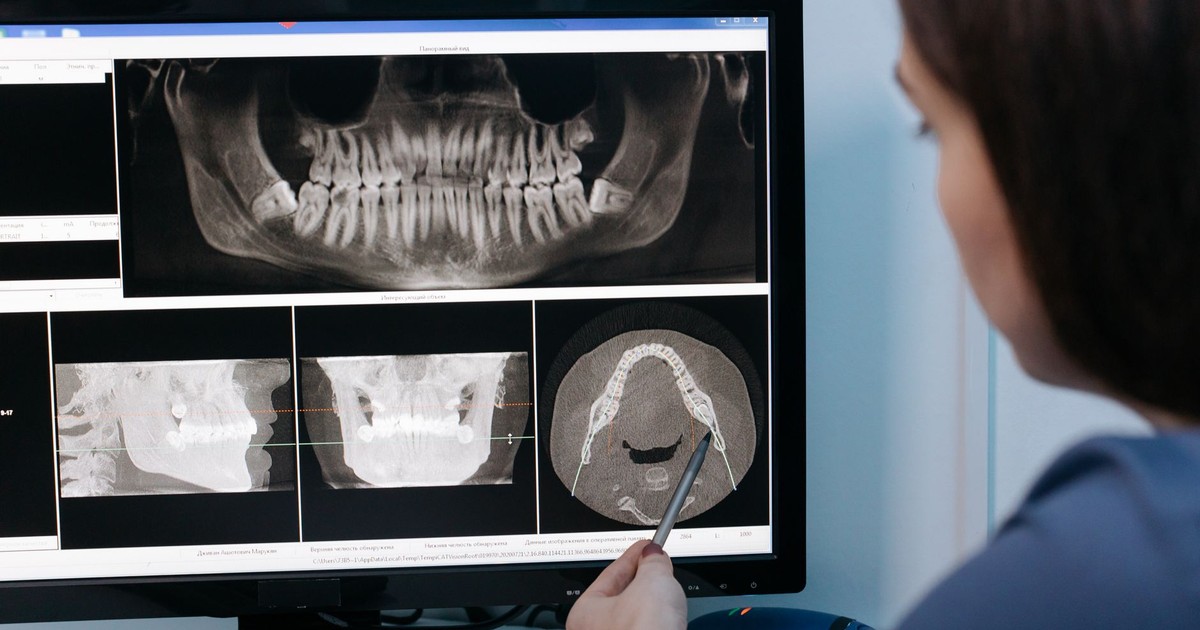 A dentist examines dental X-rays on a computer screen using a stylus for detailed analysis.