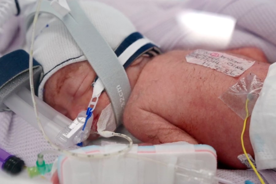 Woman gives birth to rare identical quadruplet girls in Australia