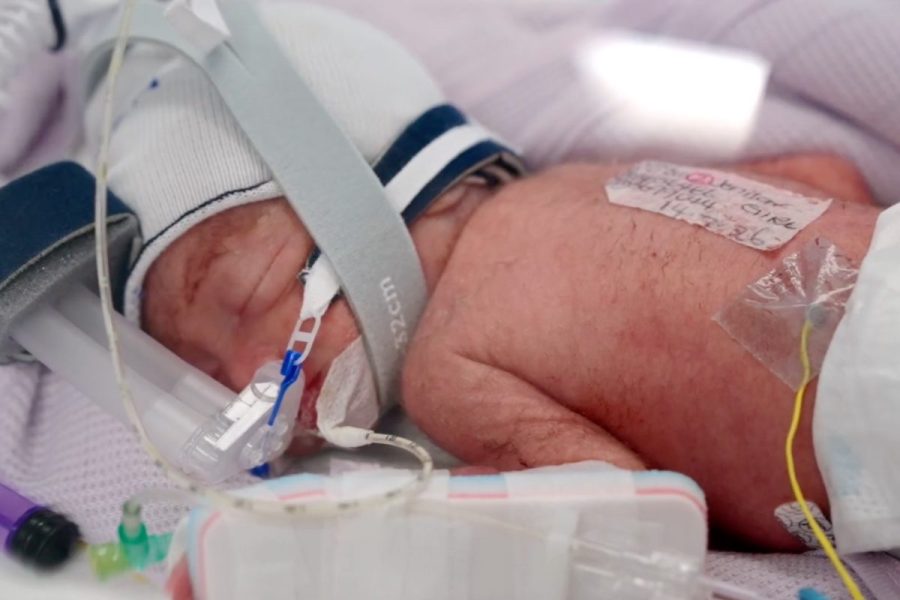 Woman gives birth to rare identical quadruplet girls in Australia