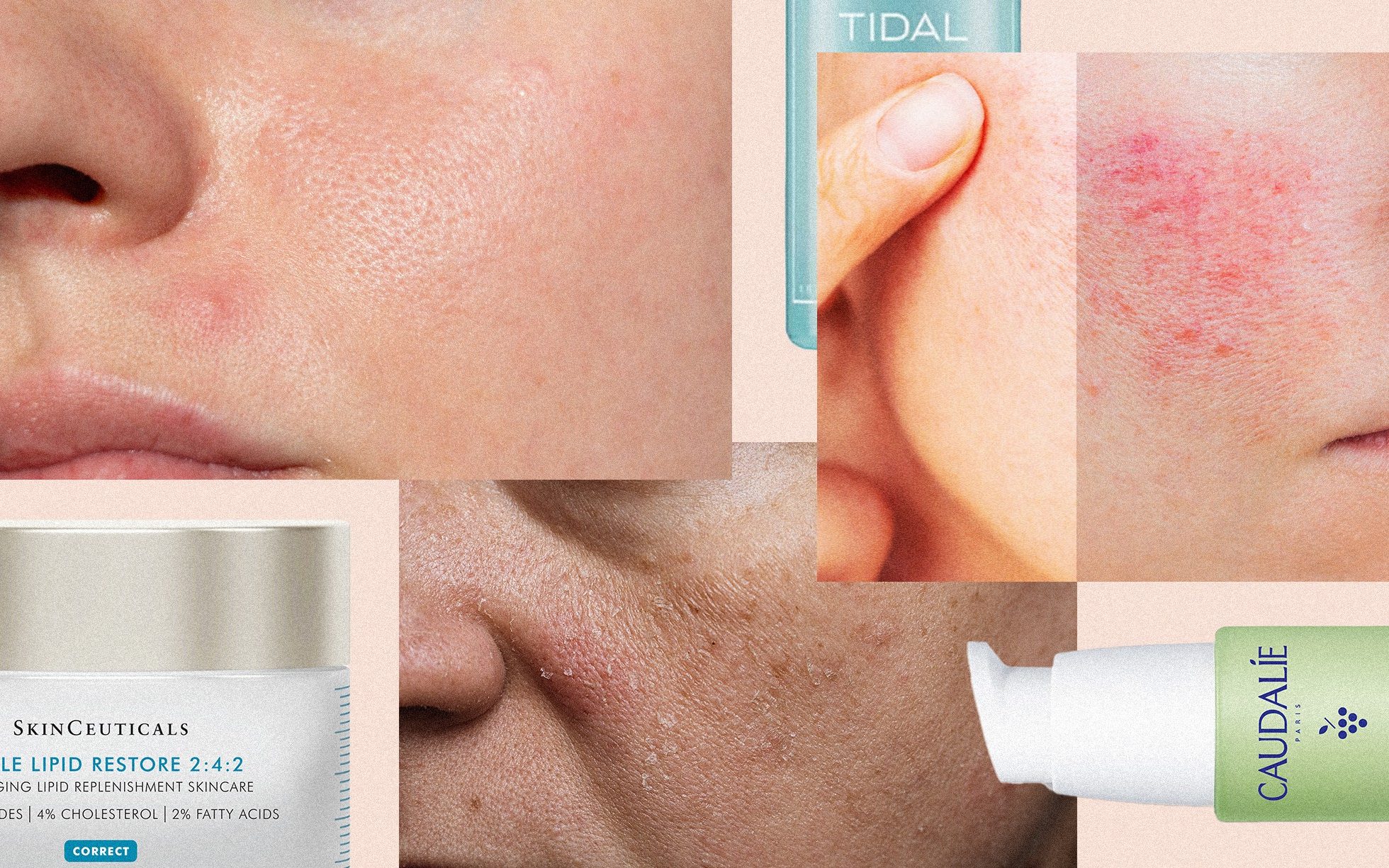 Skin type