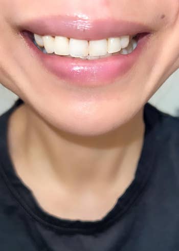 Close-up of a reviewer's lips showing lip balm
